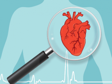 COVID Linked to Spike in Heart Attacks Among Young Adults Ages 25-44